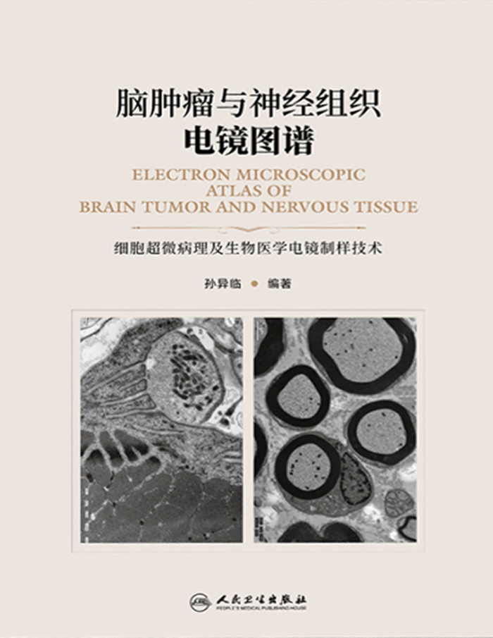 脑肿瘤与神经组织电镜图谱