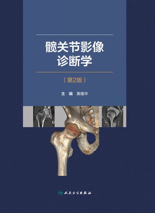 髋关节影像诊断学  (第2版)