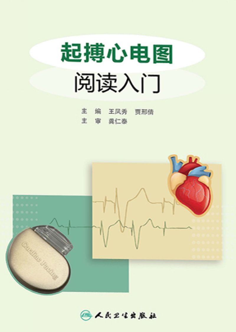 起搏心电图阅读入门