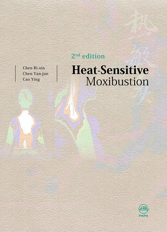 热敏灸（英文版）（第2版）