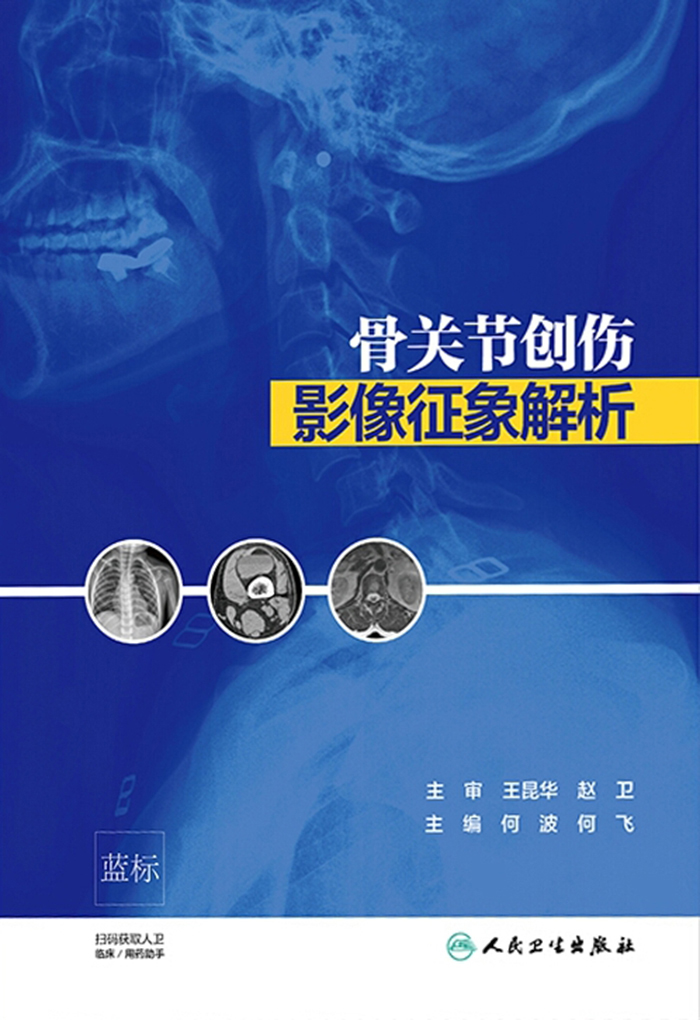 骨关节创伤影像征象解析