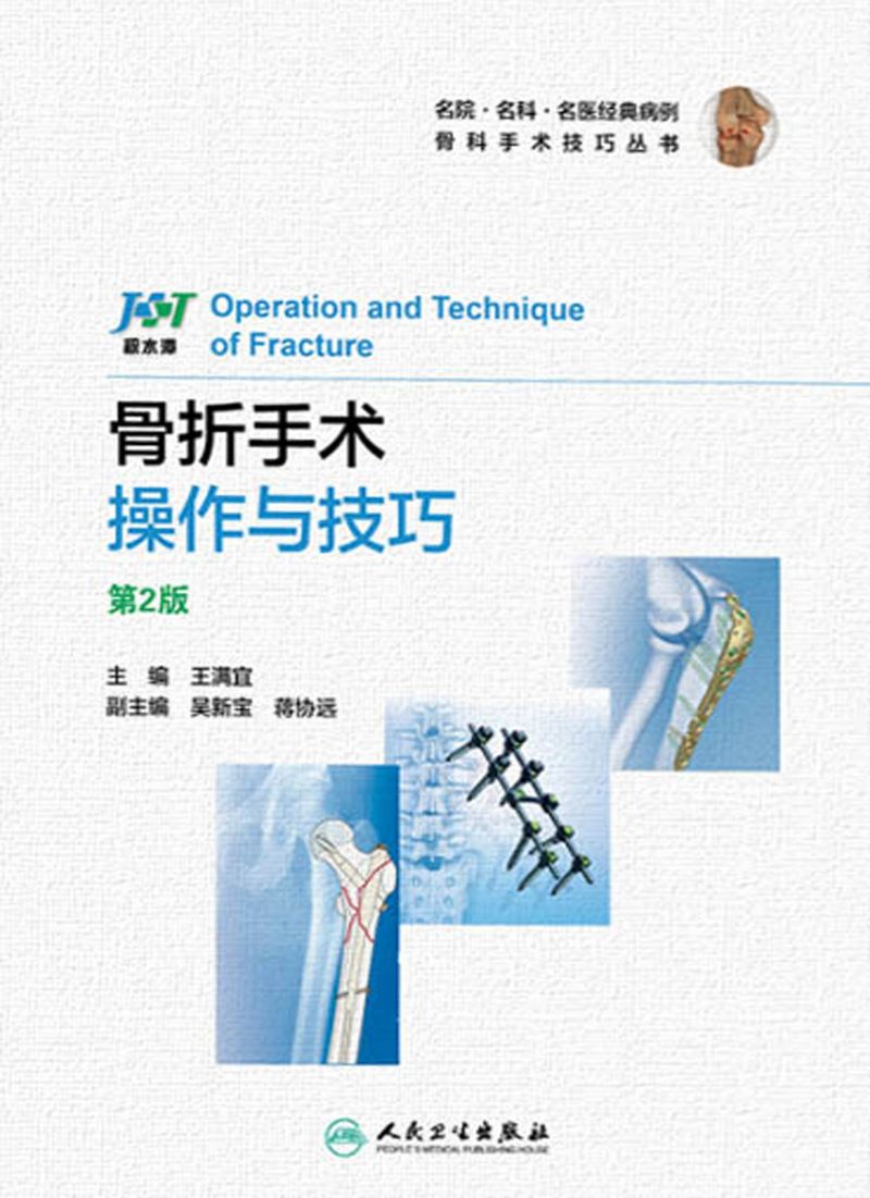 骨折手术操作与技巧（第2版）