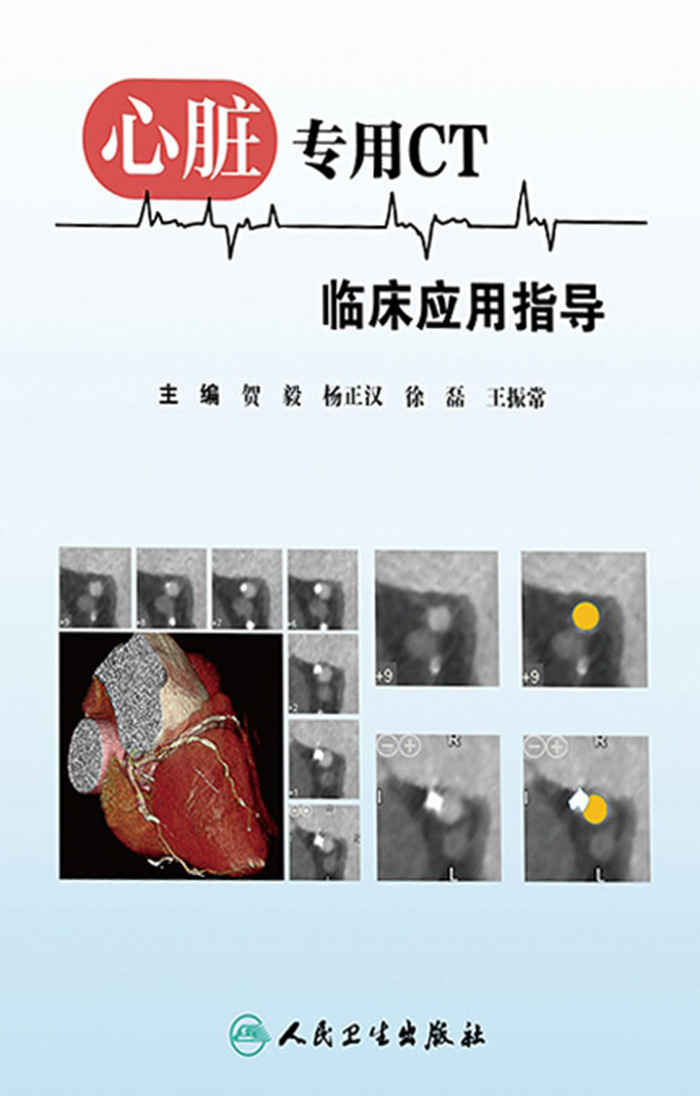 心脏专用CT临床应用指导