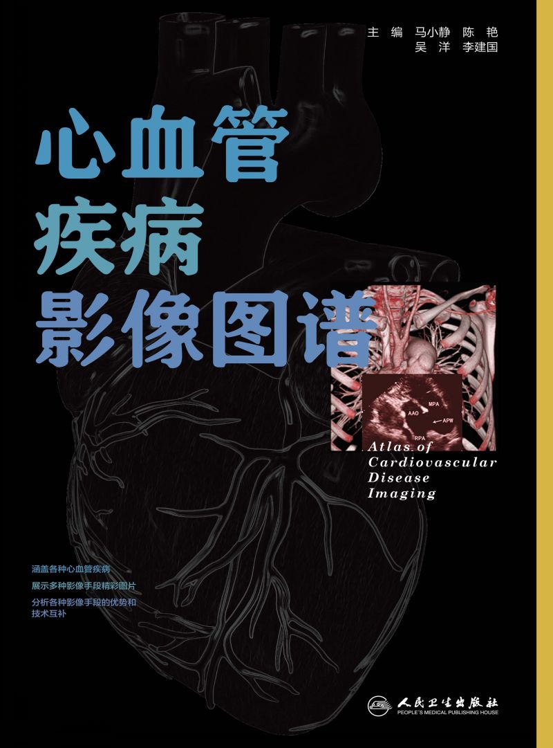 心血管疾病影像图谱