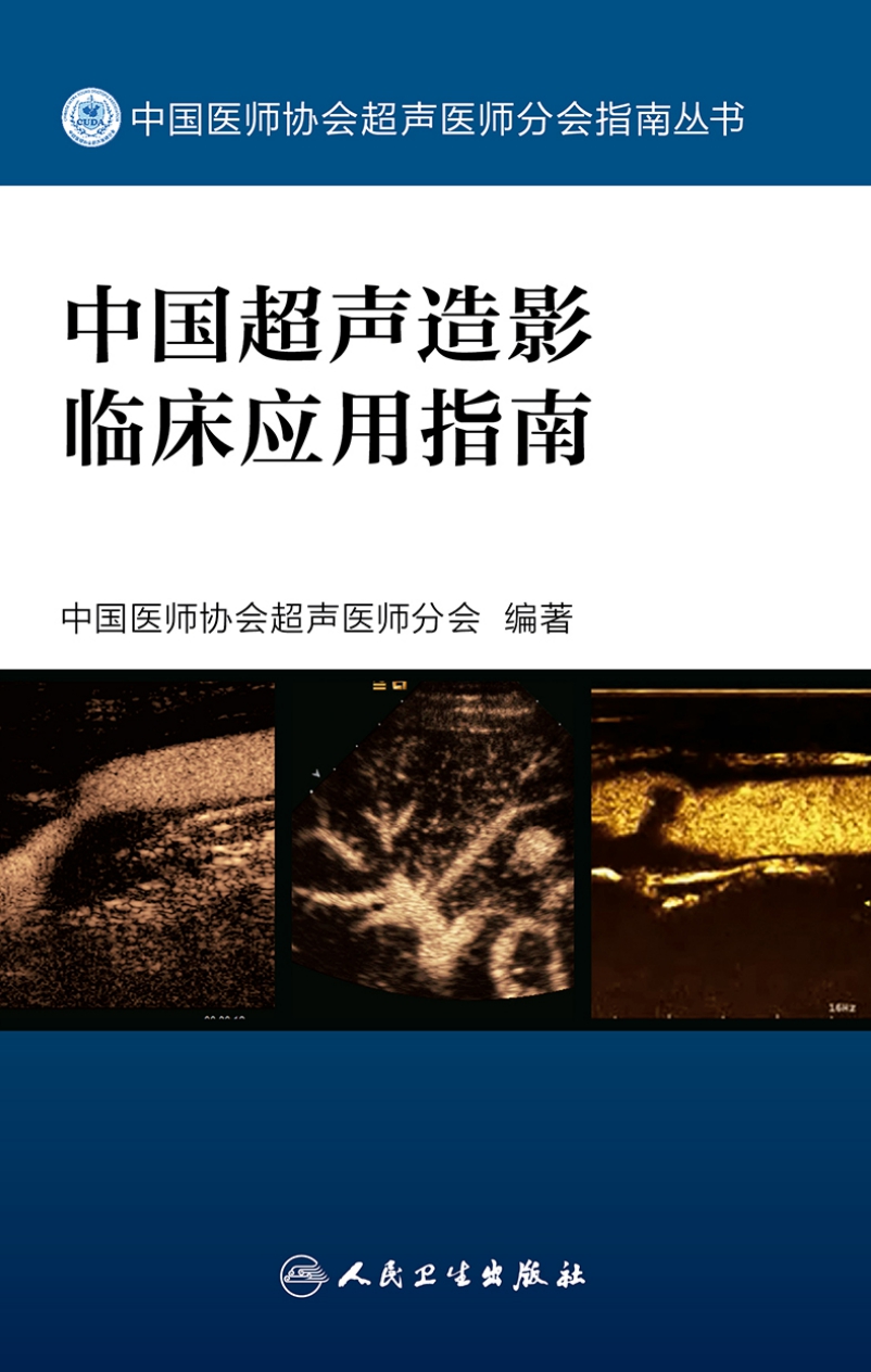 中国超声造影临床应用指南