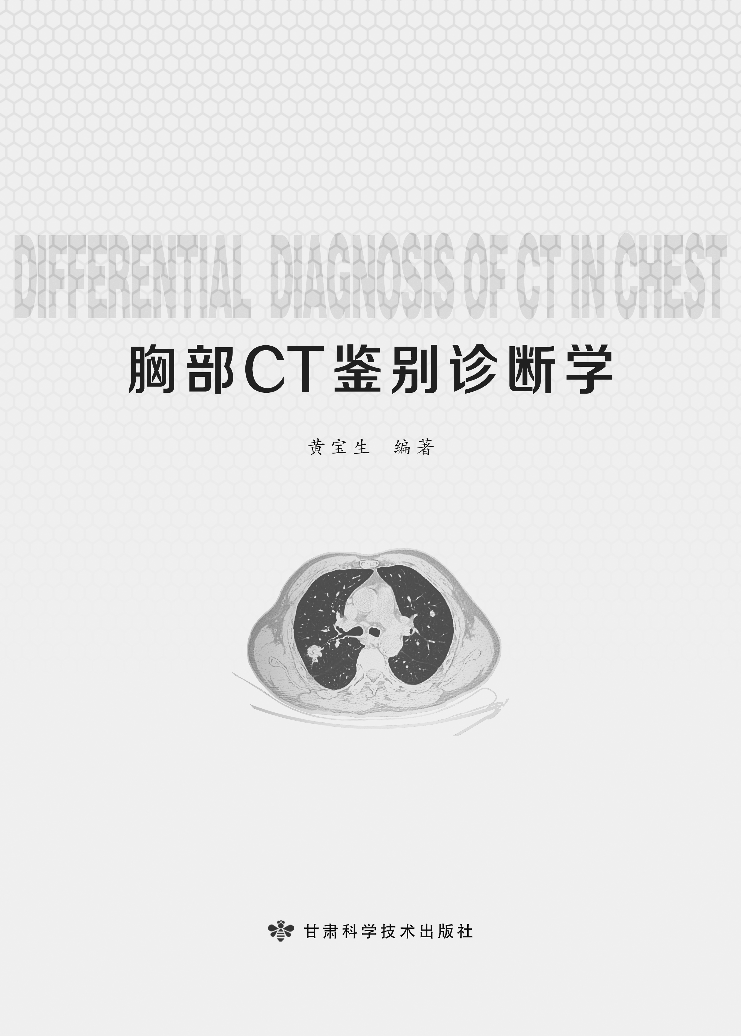 胸部CT鉴别诊断学