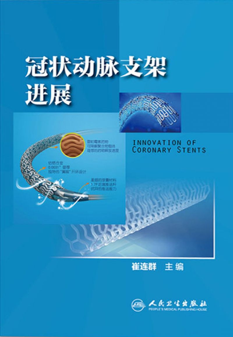 冠状动脉支架进展