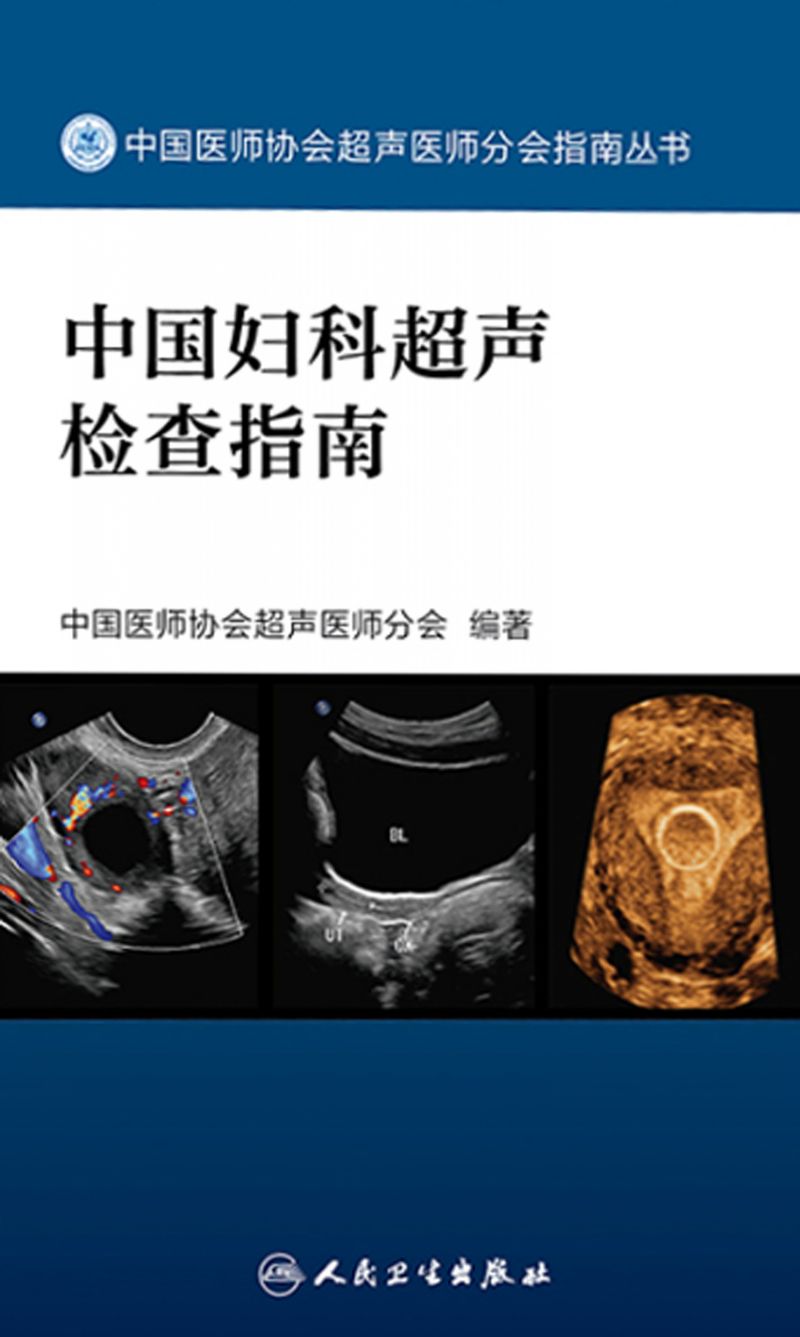 中国妇科超声检查指南