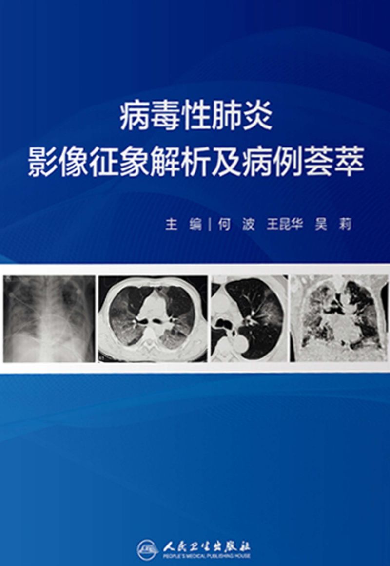 病毒性肺炎影像征象解析及病例荟萃