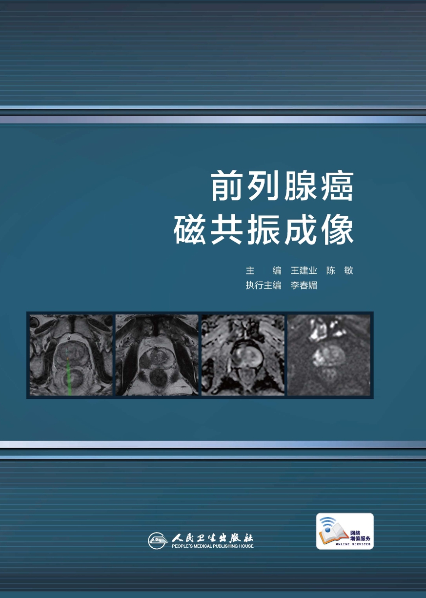 前列腺癌磁共振成像