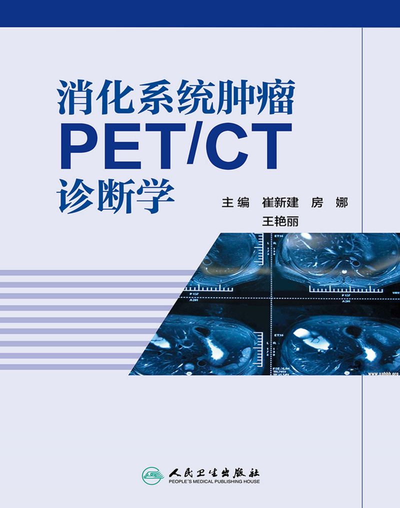 消化系统肿瘤PET/CT诊断学