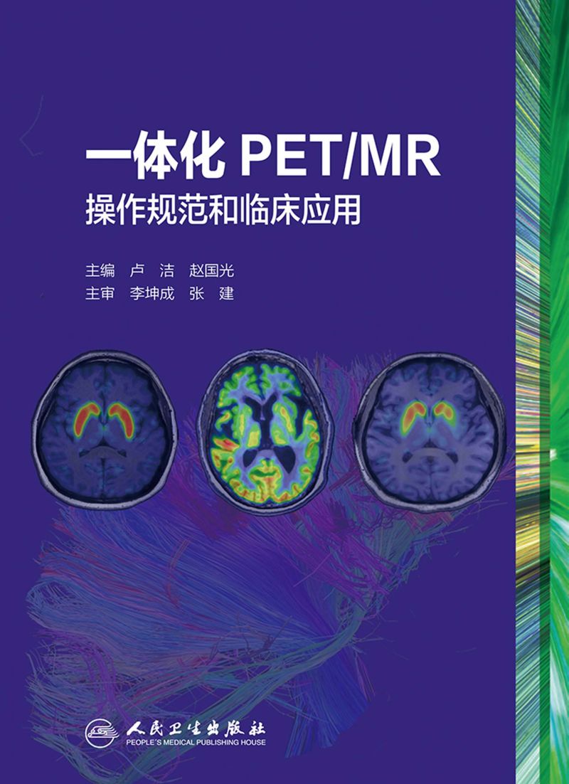 一体化PET/MR操作规范和临床应用