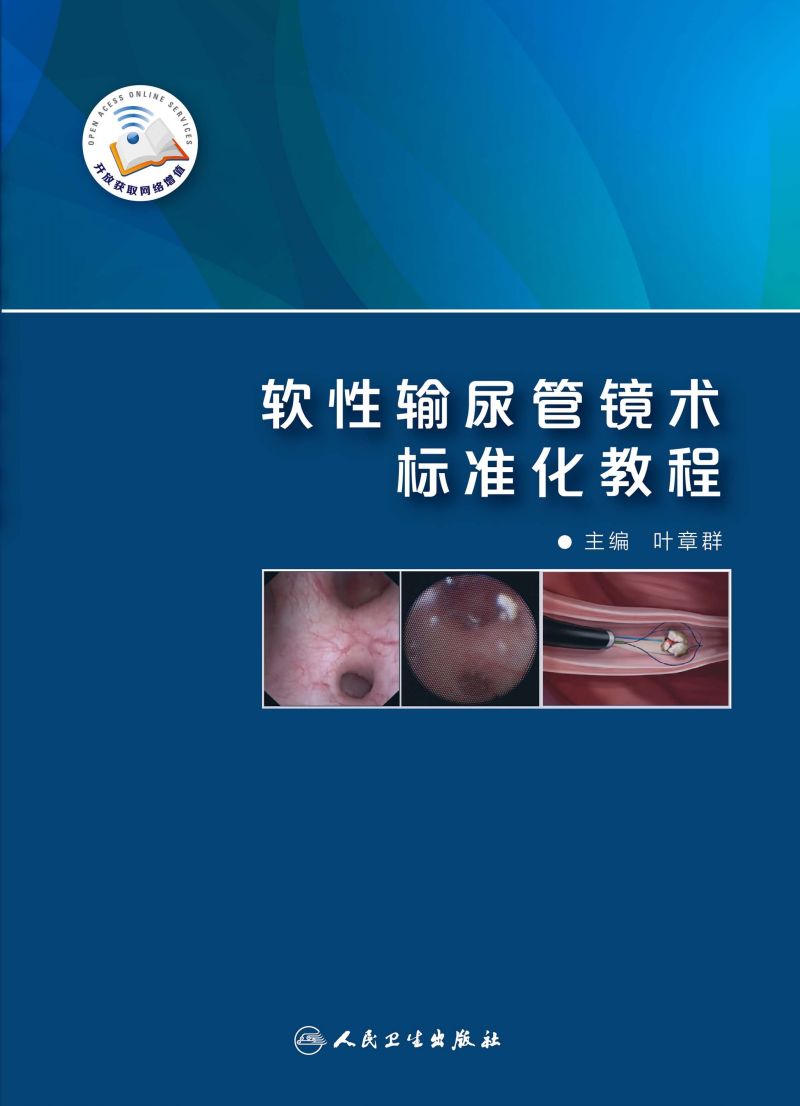 软性输尿管镜术标准化教程