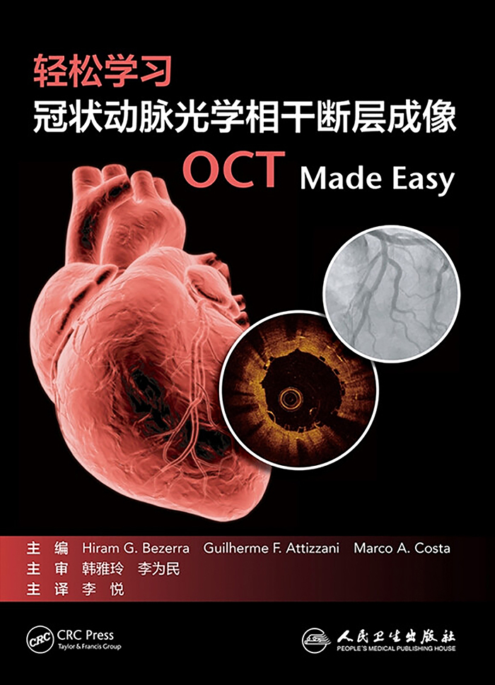 轻松学习冠状动脉光学相干断层成像