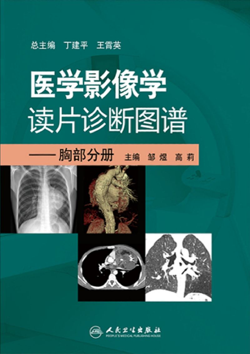 医学影像学读片诊断图谱---胸部分册