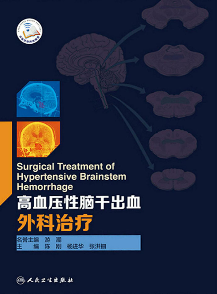 高血压性脑干出血外科治疗