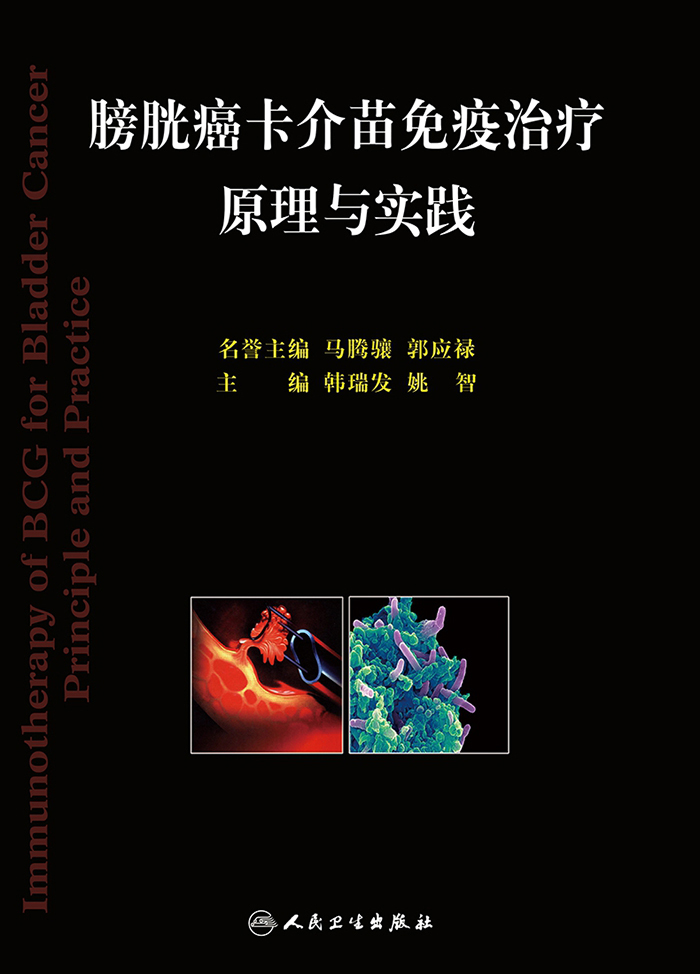 膀胱癌卡介苗免疫治疗原理与实践
