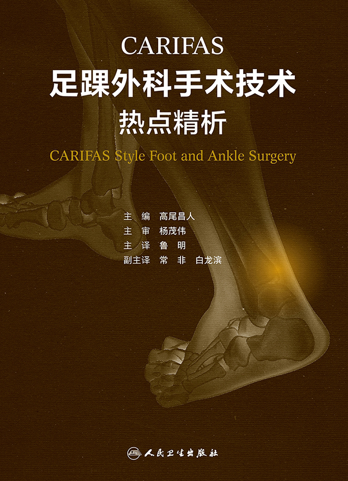 CARIFAS足踝外科手术技术：热点精析