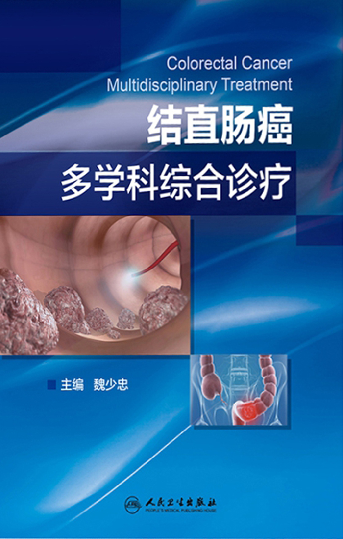 结直肠癌多学科综合诊疗