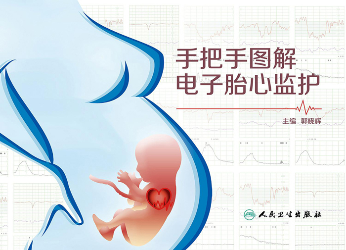 手把手图解电子胎心监护