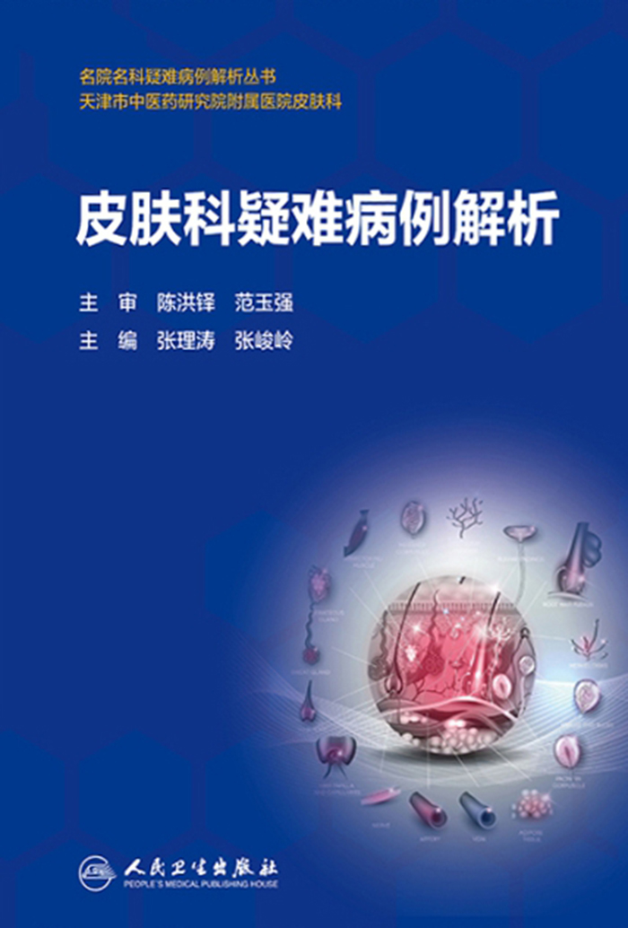 皮肤科疑难病例解析