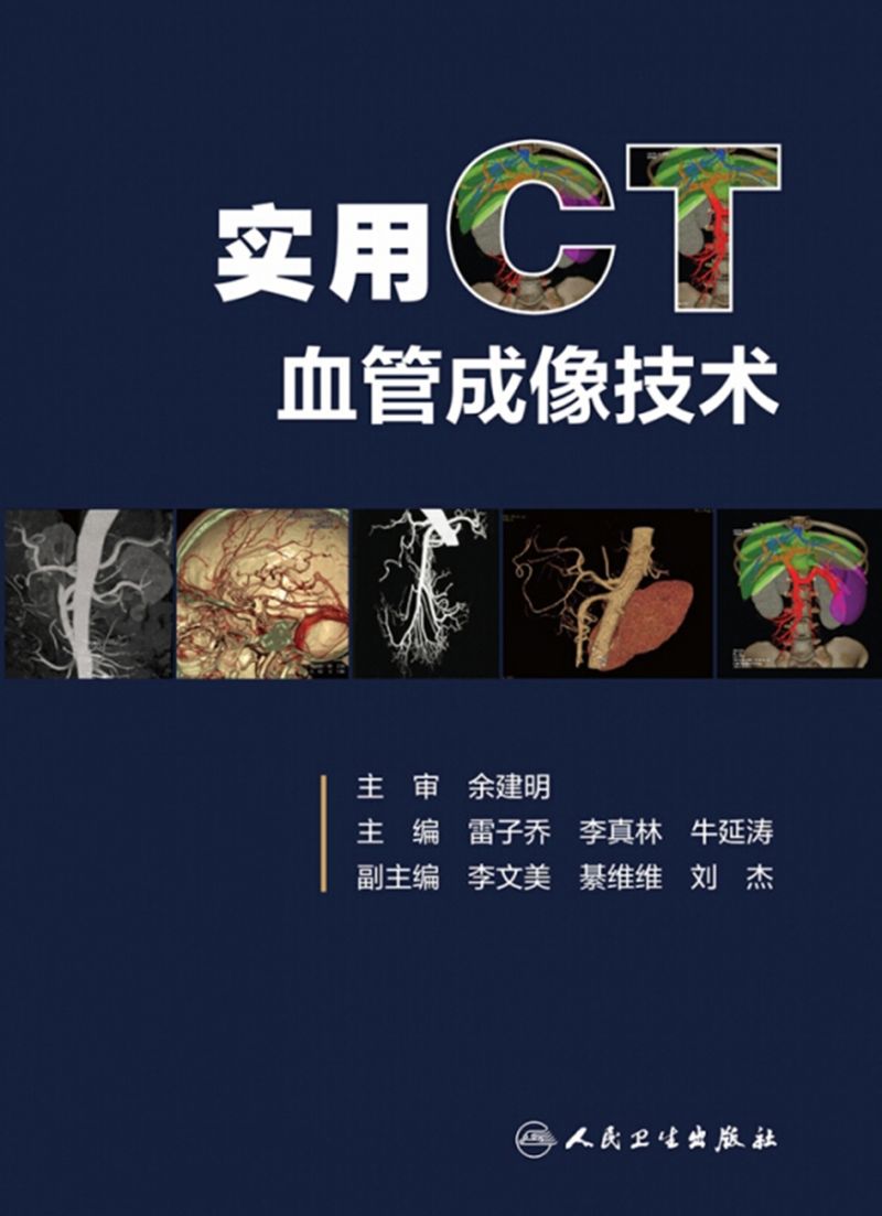 实用CT血管成像技术