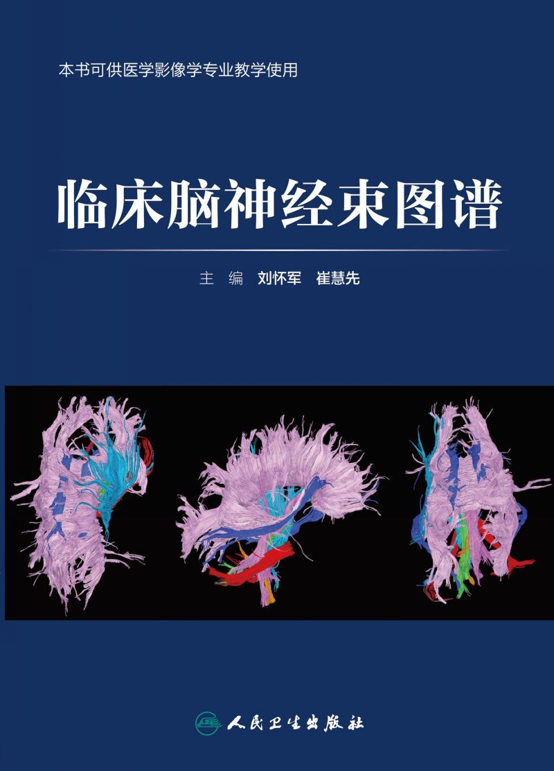 临床脑神经束图谱