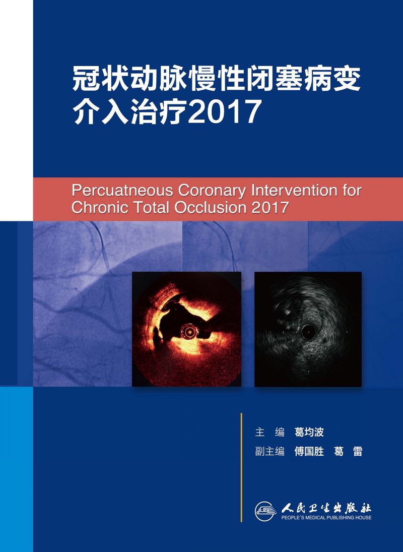 冠状动脉慢性闭塞病变介入治疗2017