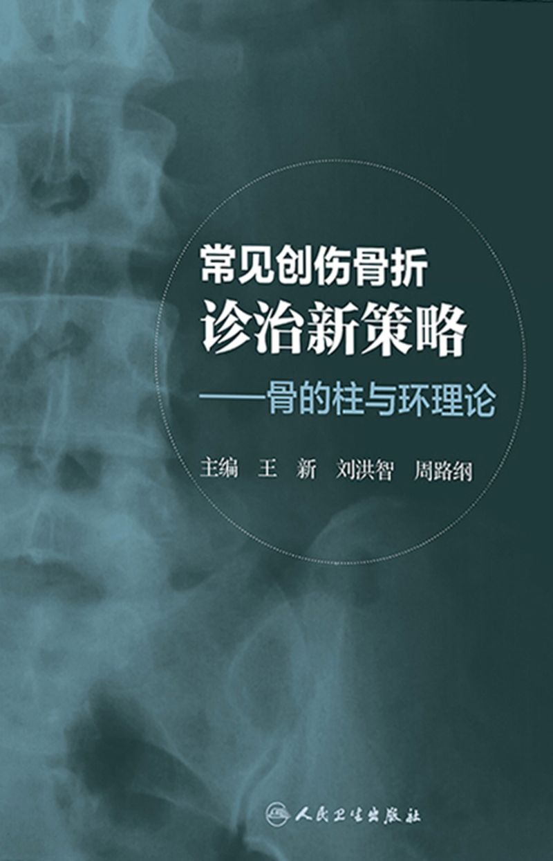 常见创伤骨折诊治新策略：骨的柱与环理论