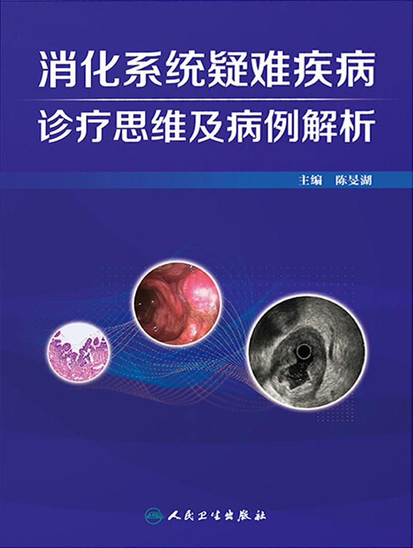 消化系统疑难疾病诊疗思维及病例解析. 第二辑