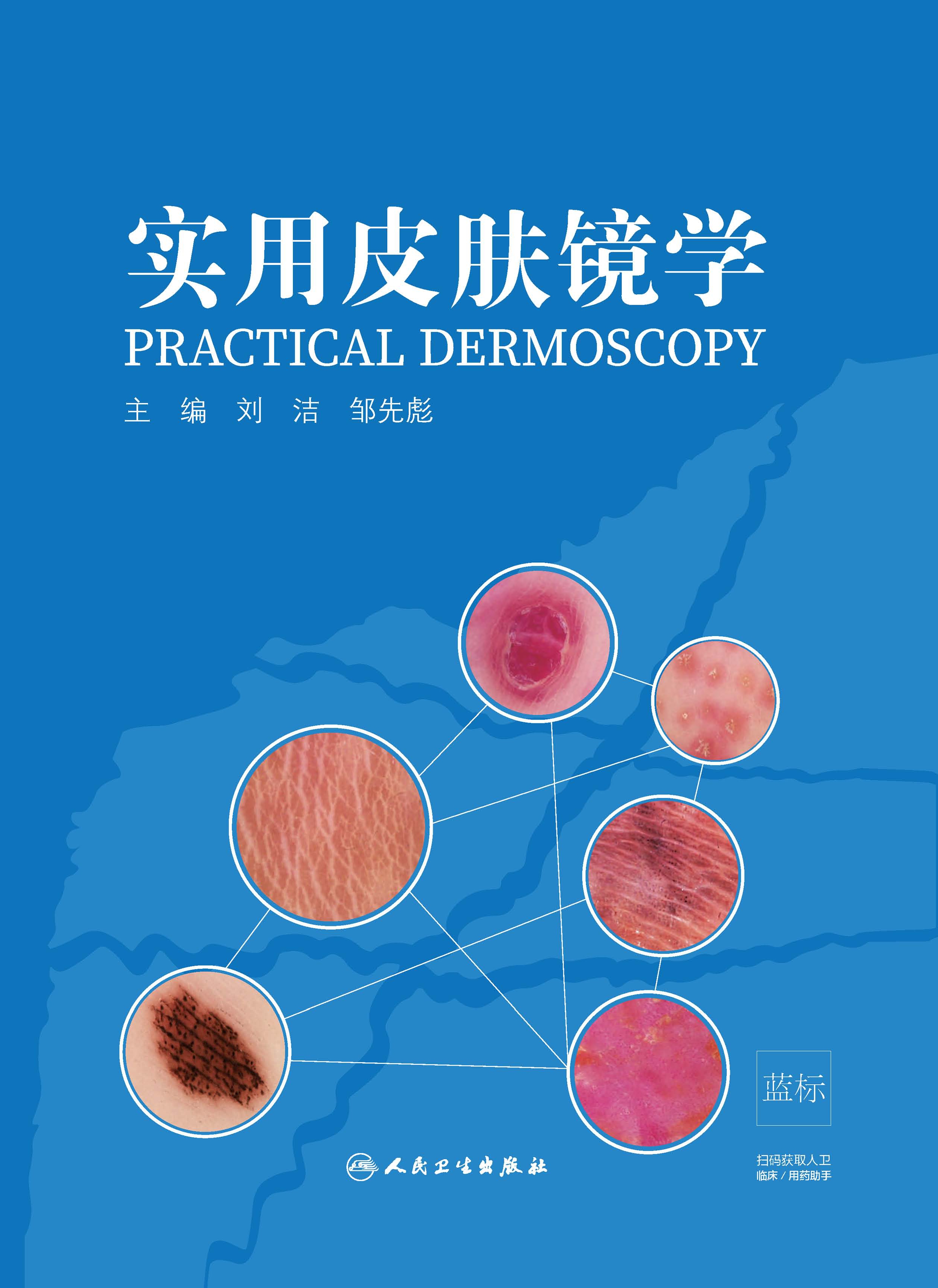 实用皮肤镜学
