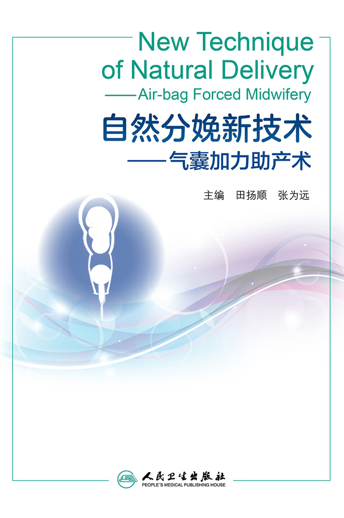 自然分娩新技术——气囊加力助产术