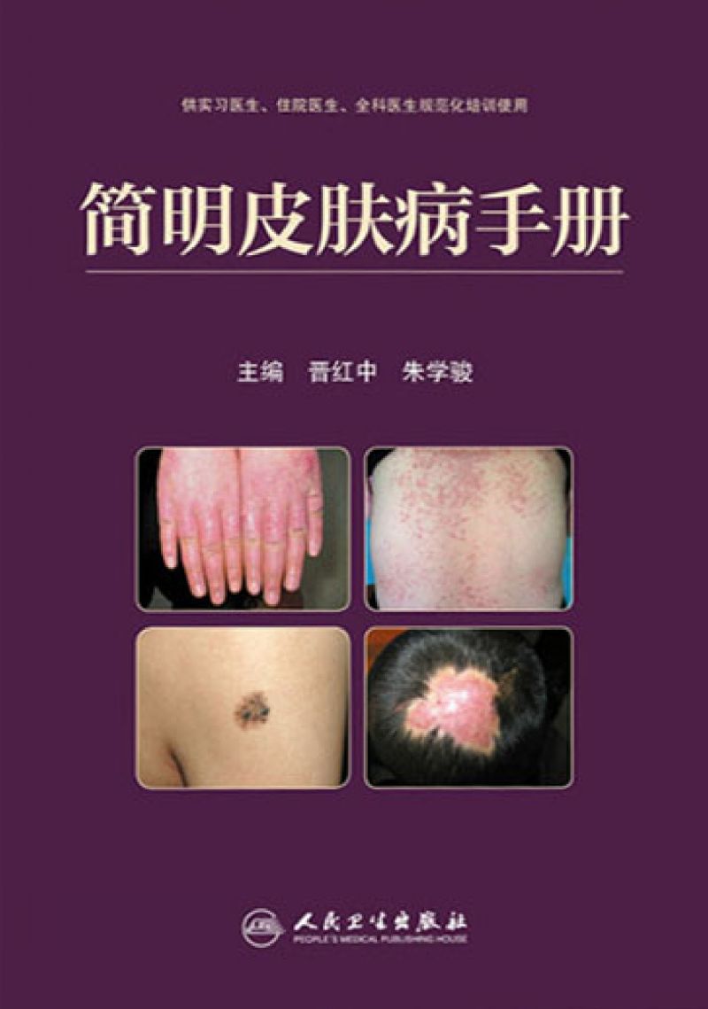 简明皮肤病手册