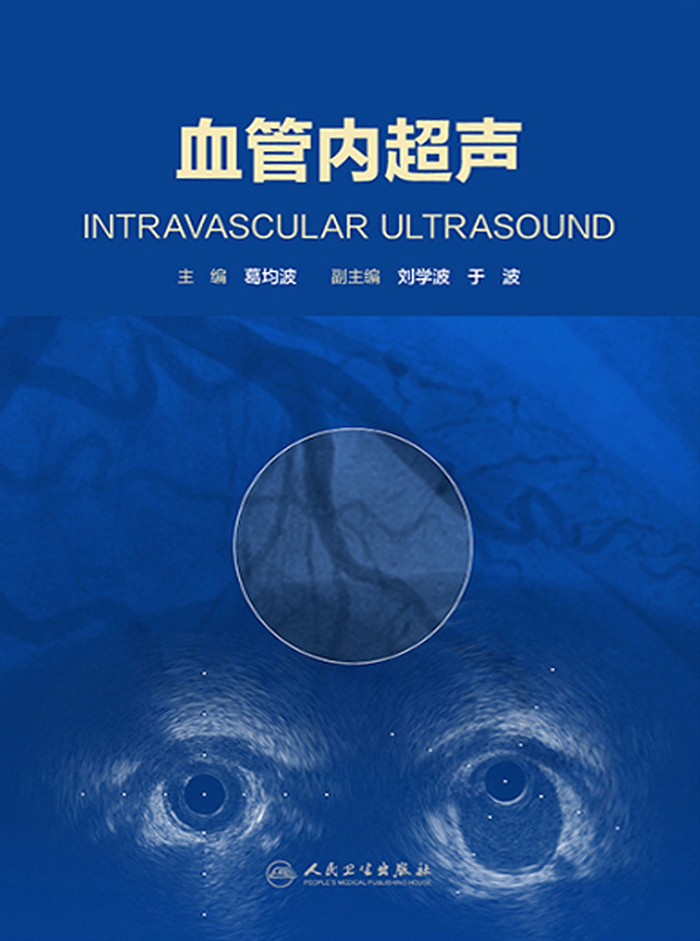 血管内超声