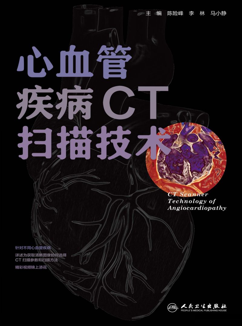 心血管疾病CT扫描技术
