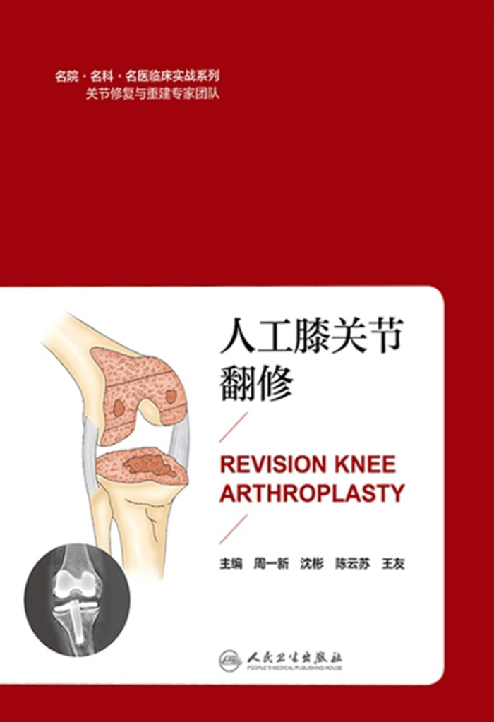 人工膝关节翻修