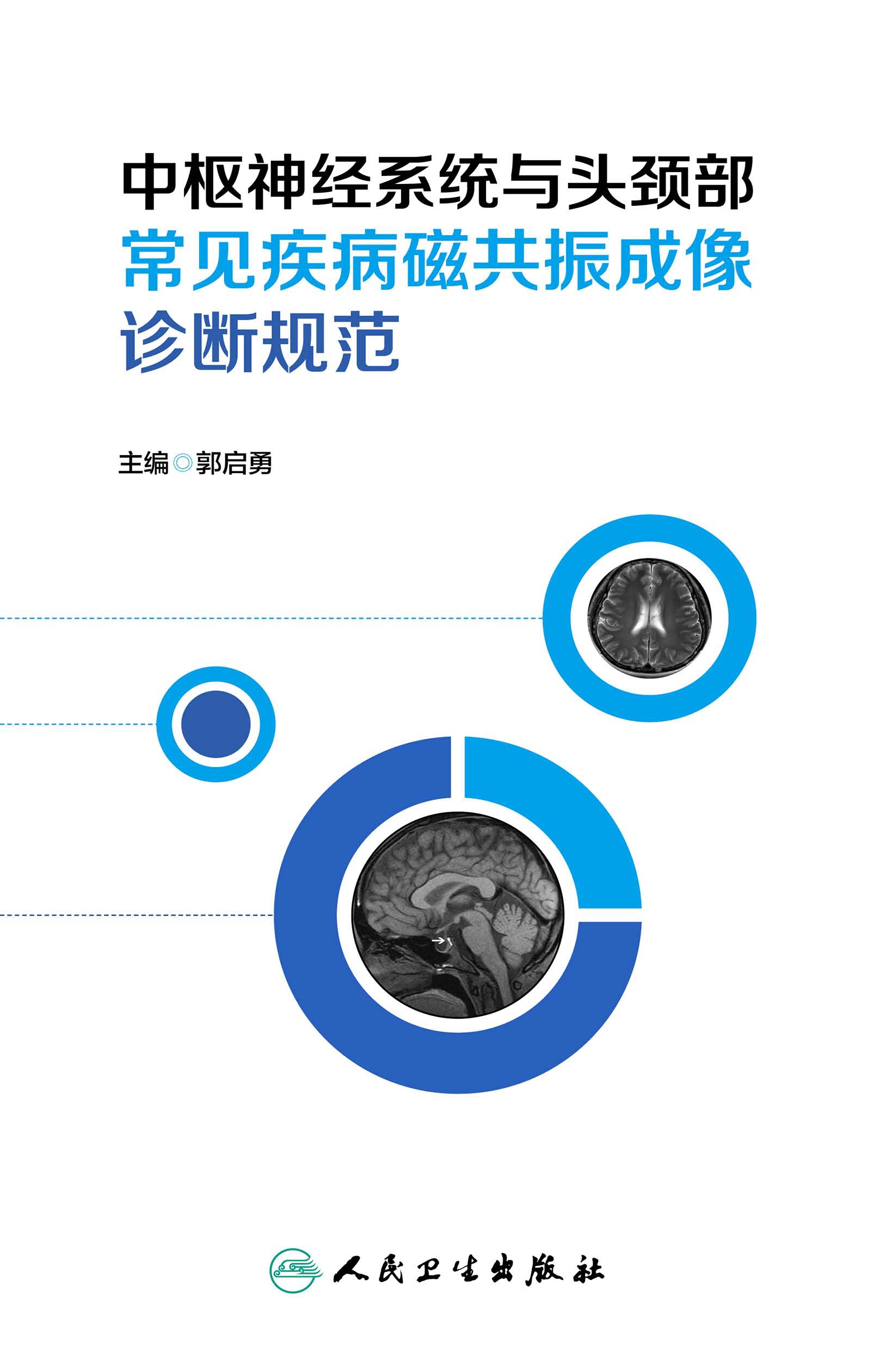 中枢神经系统与头颈部常见疾病磁共振成像诊断规范