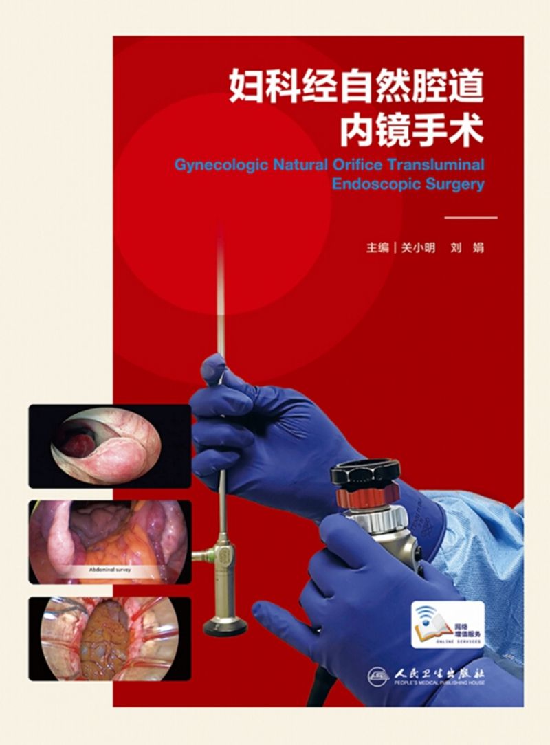 妇科经自然腔道内镜手术