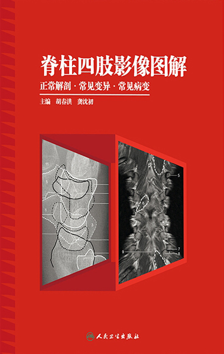 脊柱四肢影像图解——正常解剖·常见变异·常见病变