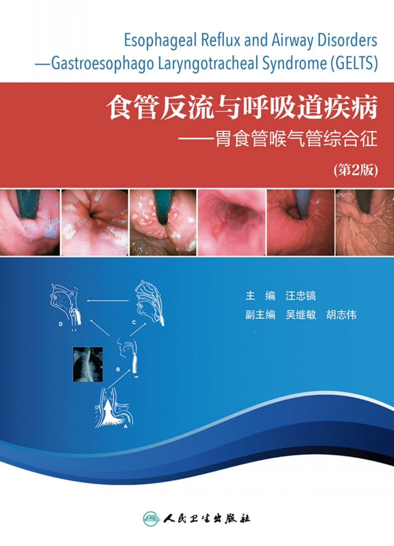 食管反流与呼吸道疾病——胃食管喉气管综合征