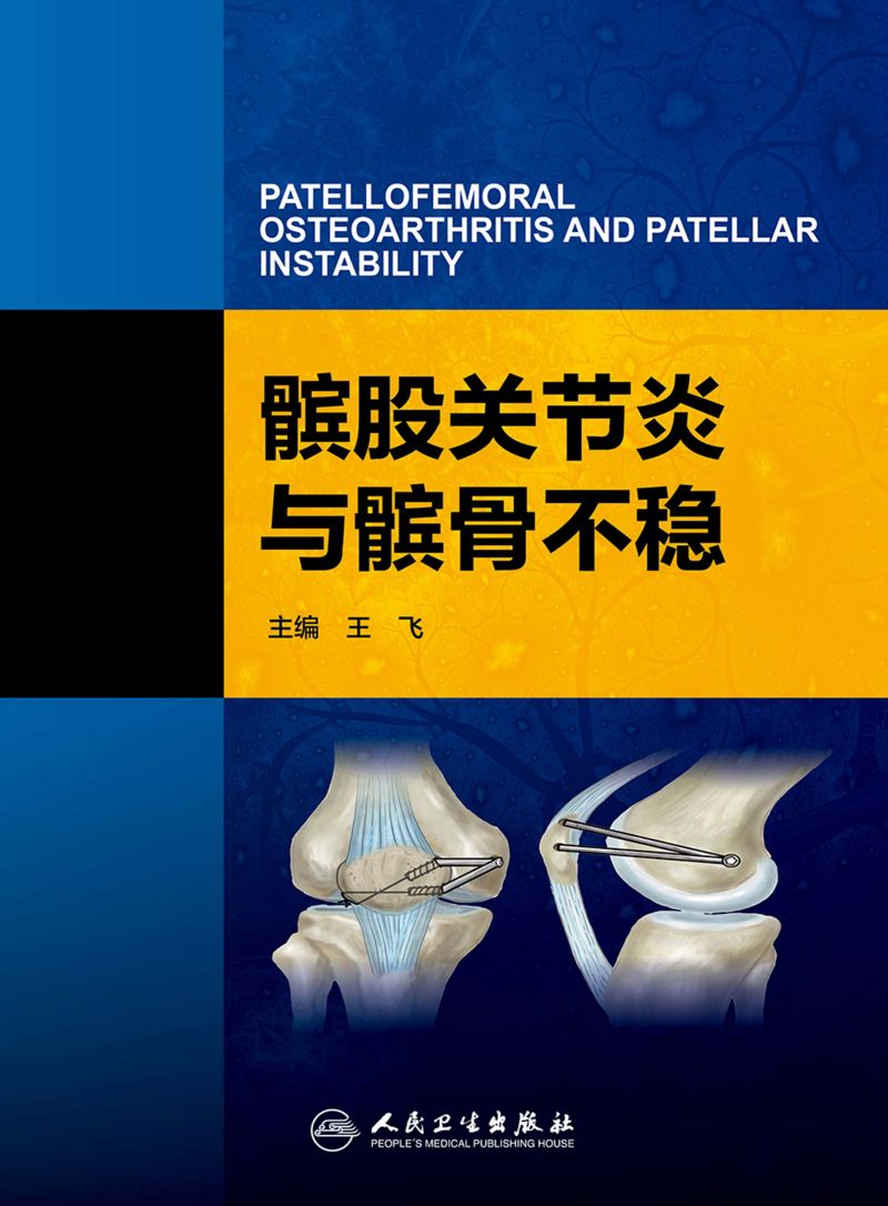 髌股关节炎与髌骨不稳