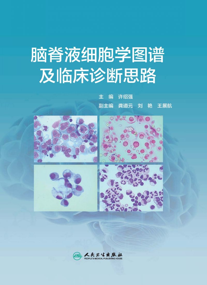 脑脊液细胞学图谱及临床诊断思路