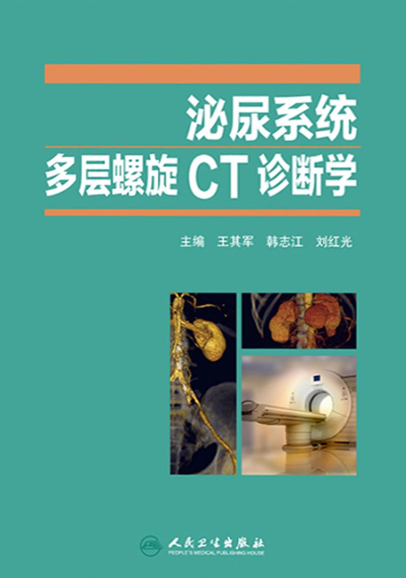 泌尿系统多层螺旋CT诊断学
