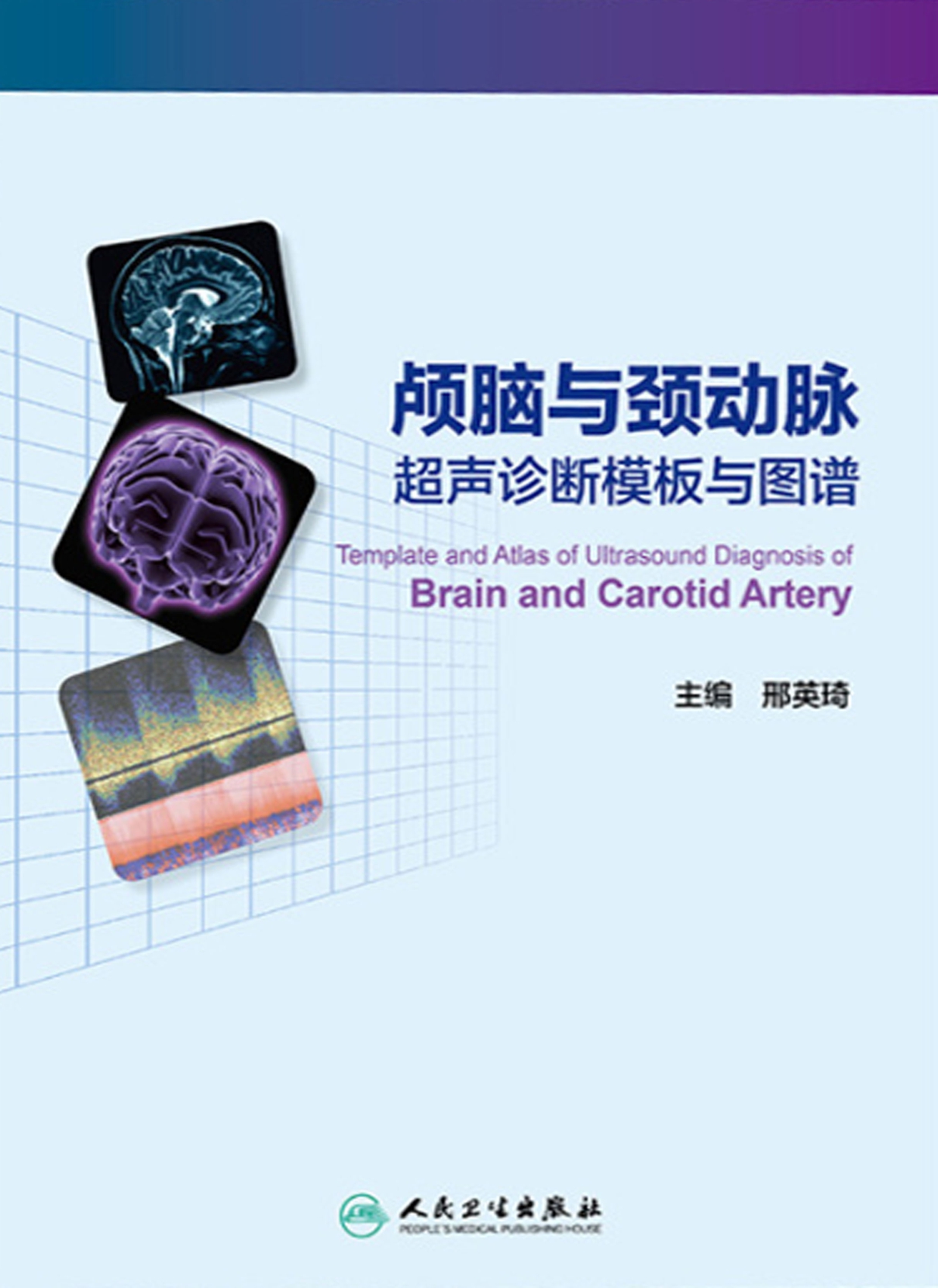 颅脑与颈动脉超声诊断模板与图谱
