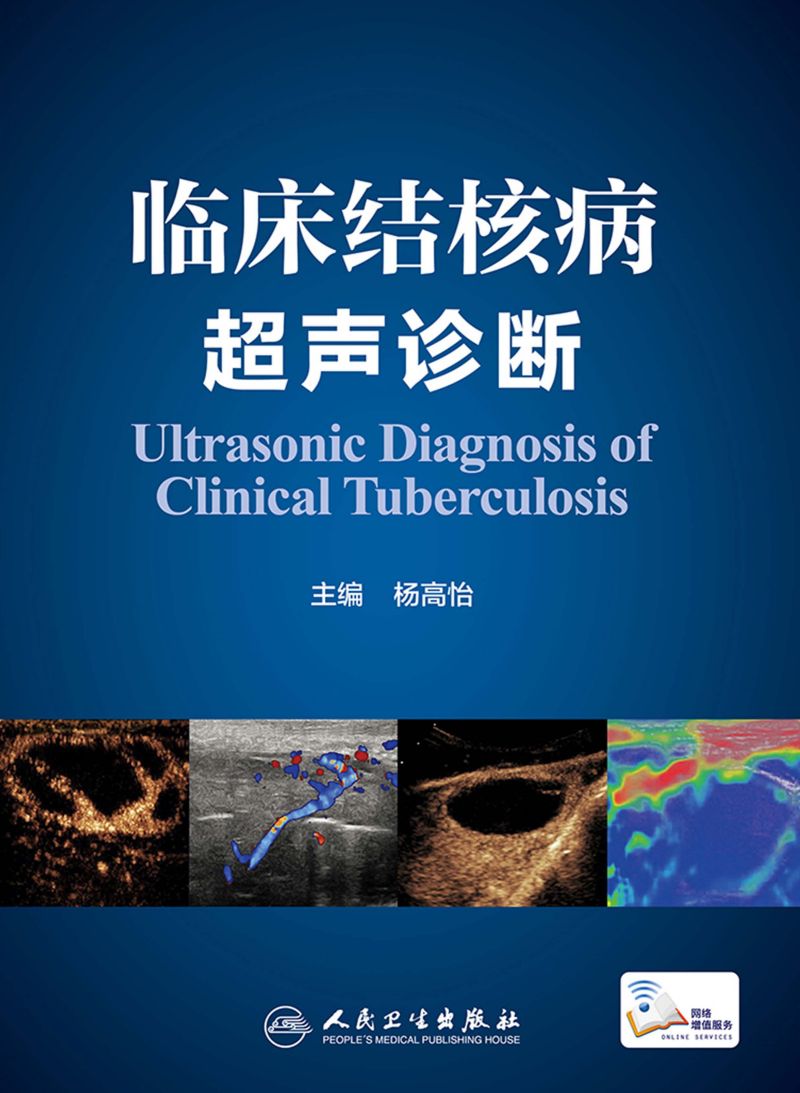 临床结核病超声诊断