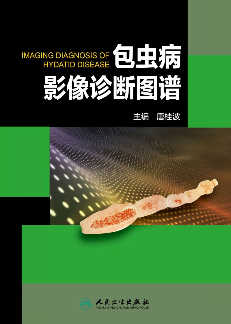 包虫病影像诊断图谱