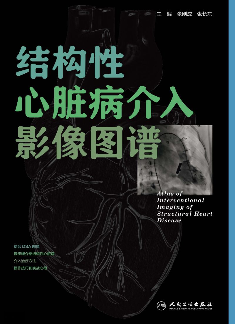 结构性心脏病介入影像图谱