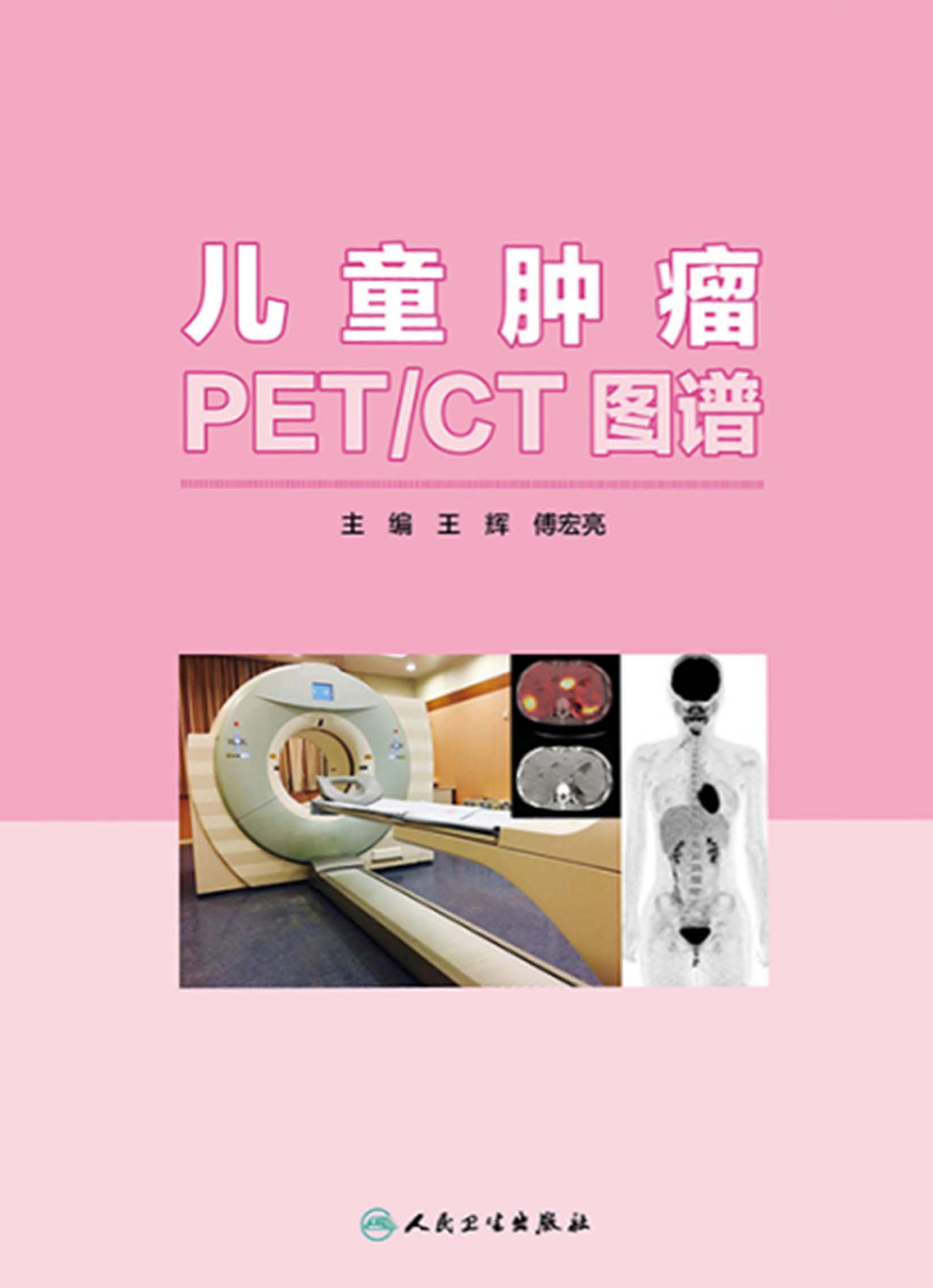儿童肿瘤PET／CT图谱