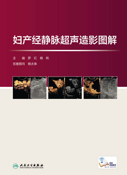 妇产经静脉超声造影图解