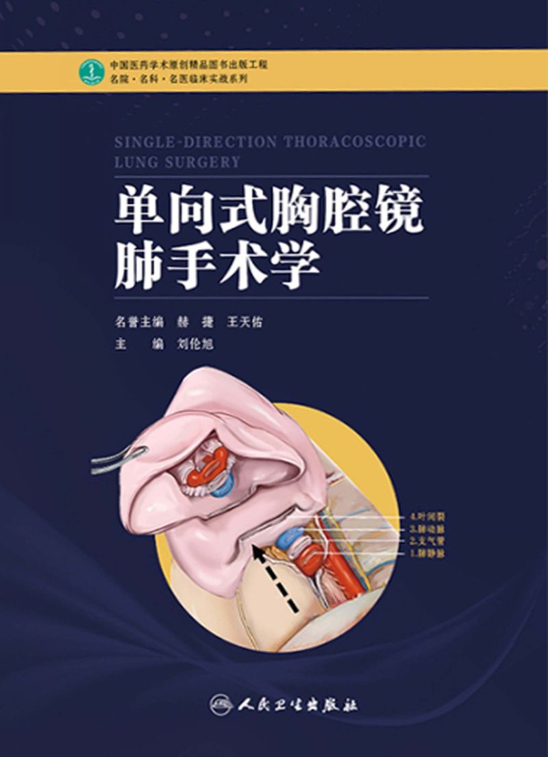 单向式胸腔镜肺手术学
